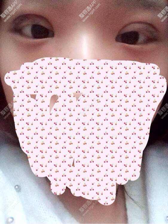 ʽ˫Ƥ참,᲻ʧ,õ.