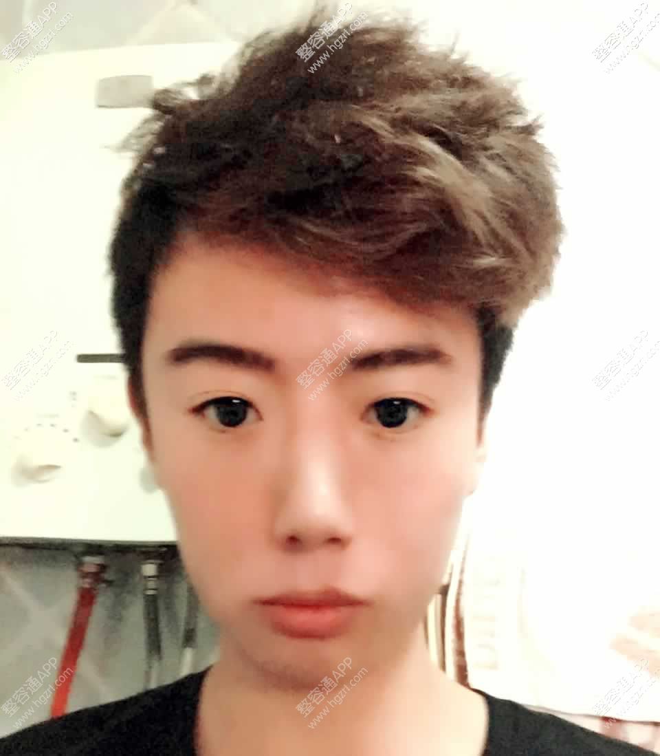 我是国字脸,想使脸变小点我是男生不知道什么脸型适合图片